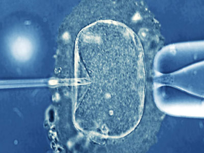 Νέες εξελίξεις στην εξωσωματική γονιμοποίηση Νέες εξελίξεις στην εξωσωματική γονιμοποίηση